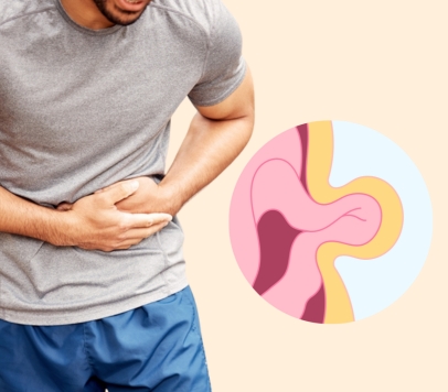 What is a hernia?